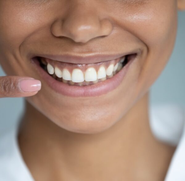 HOW TO KEEP YOUR TOOTH ENAMEL HEALTHY